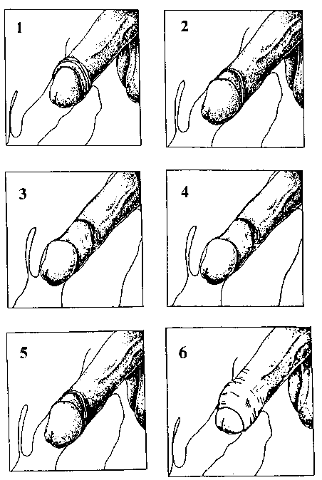 Gay Sex Intercourse Diagram