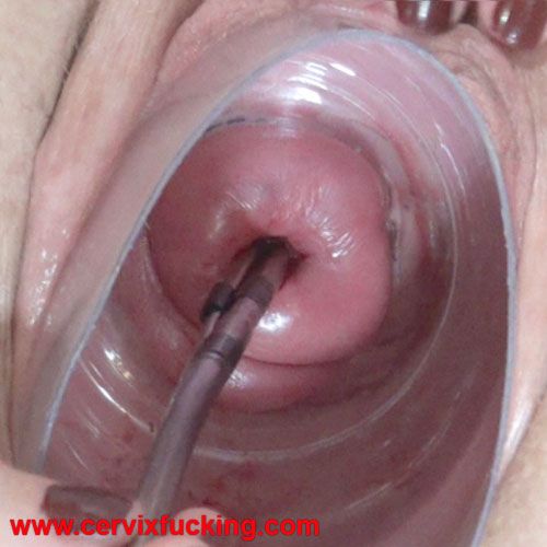 Cervix Penetration By Penis