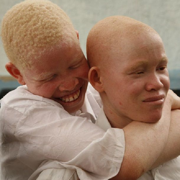 sexy albino woman