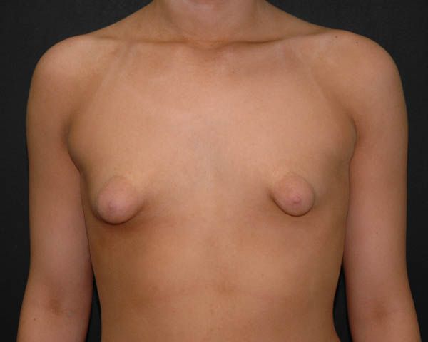 really big nipples