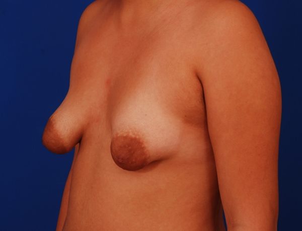 big breasted women