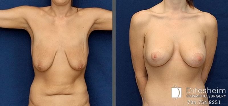 boob growth transformation