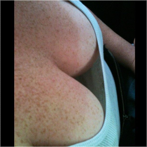no bra cleavage freckled areola