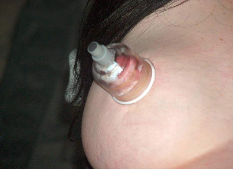 extreme nipple suction