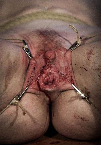 electric shock torture of women