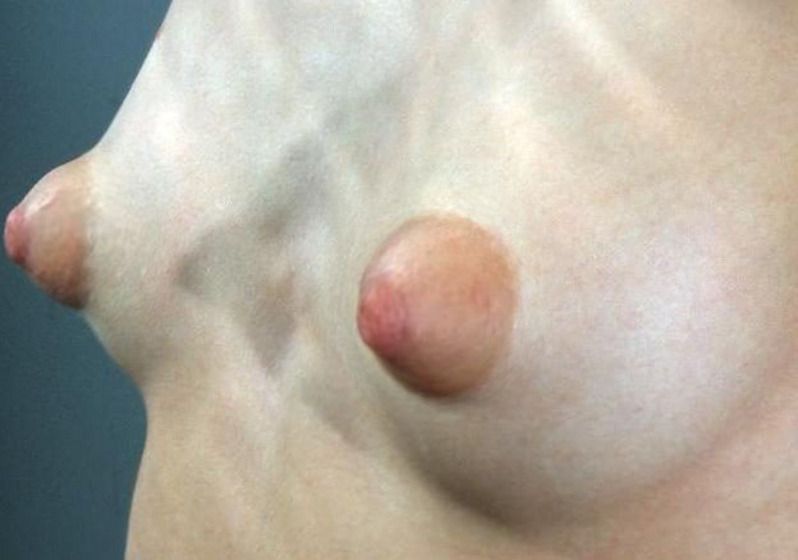beautiful asian breasts erect nipples
