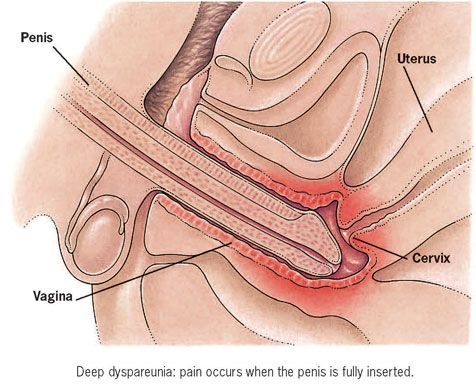 penis entering vagina