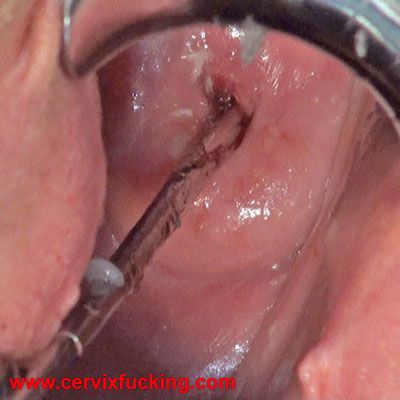 cervix penetration creampie