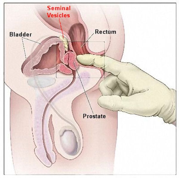 different ways of milking prostate