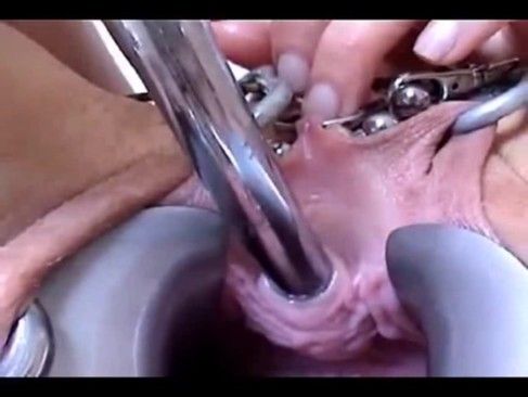 female urethral sounding