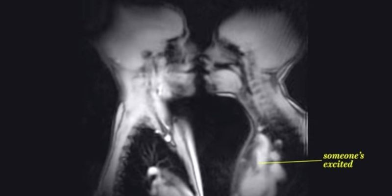 oral sex x ray