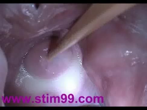 hitting my cervix during sex