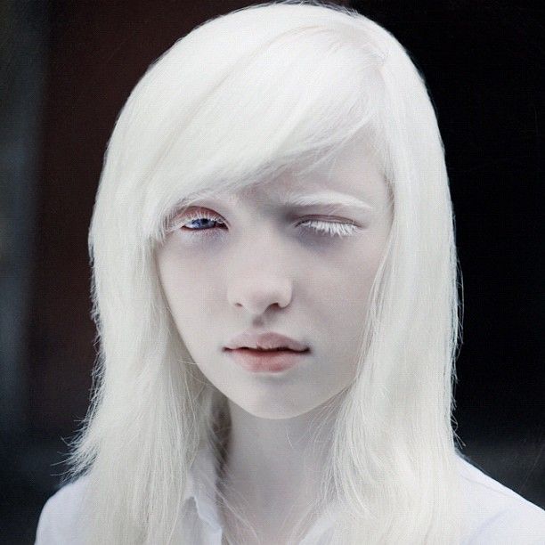 albino supermodels