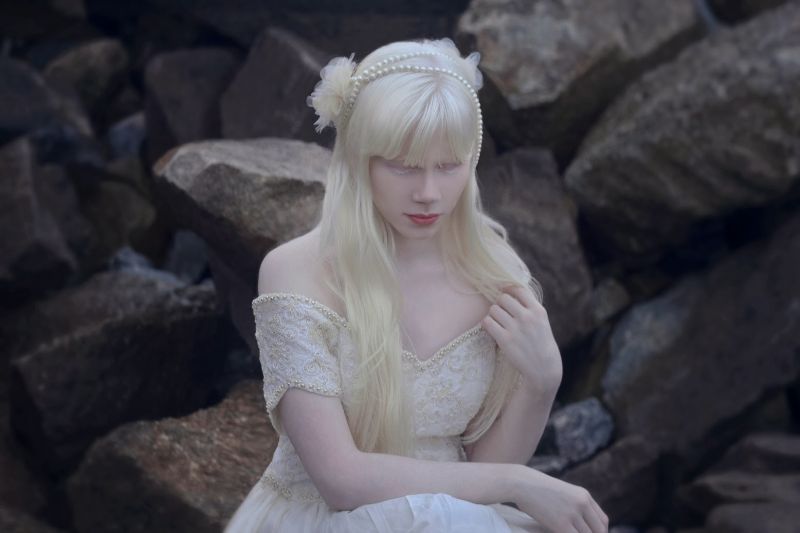 russian albino girl