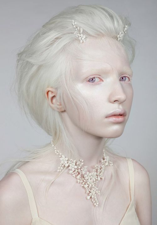 sexy albino people
