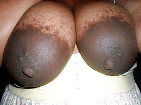 large areolas