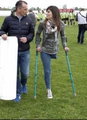 one legged woman walking