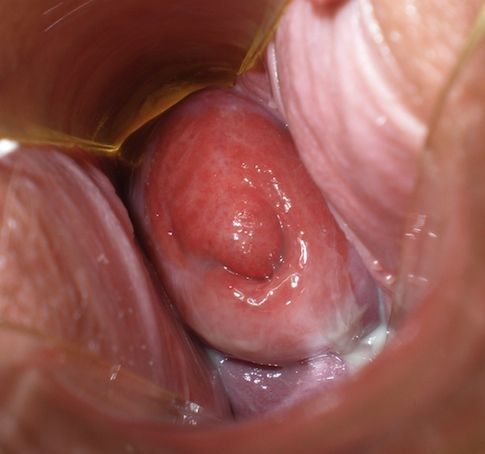vigina hole sperm