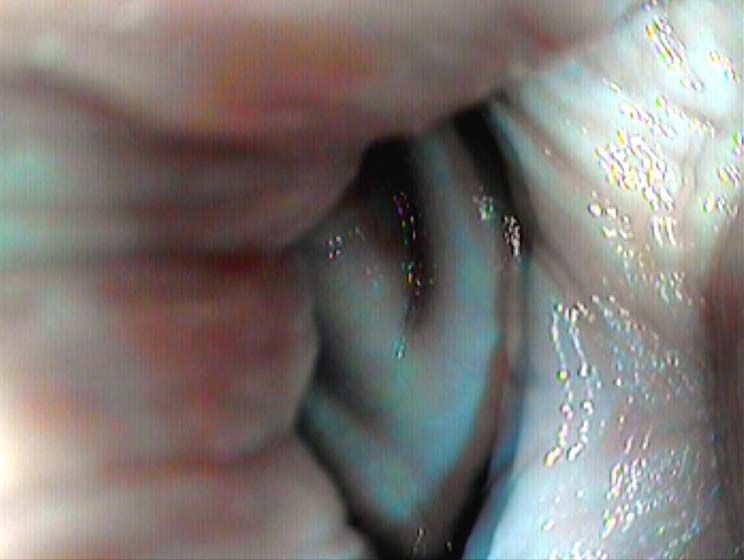 Vagina camera inside Vaginal Orgasms: