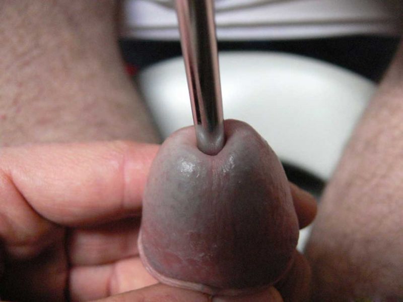penis urethra torture