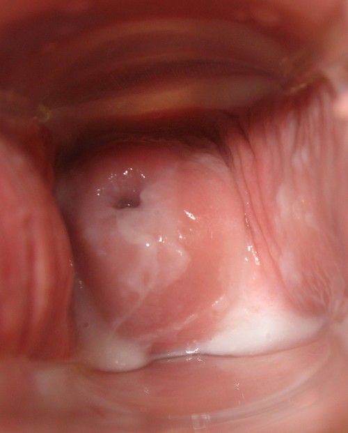 Creamy Vaginal Discharge Cum