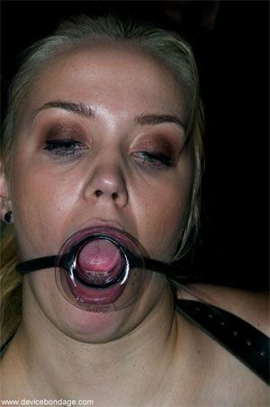 dental mouth opener bondage