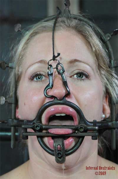 wide open mouth gag extreme