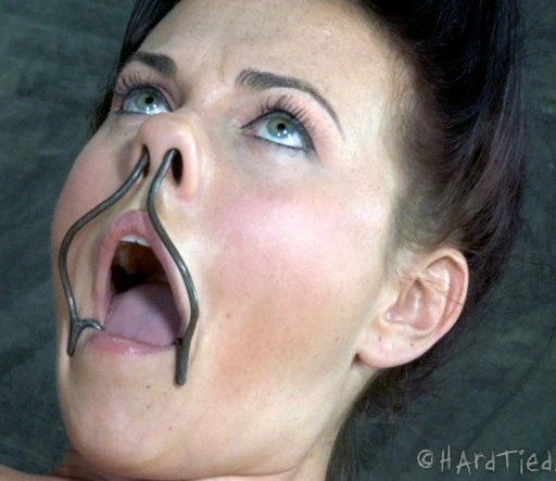 forced open mouth gag