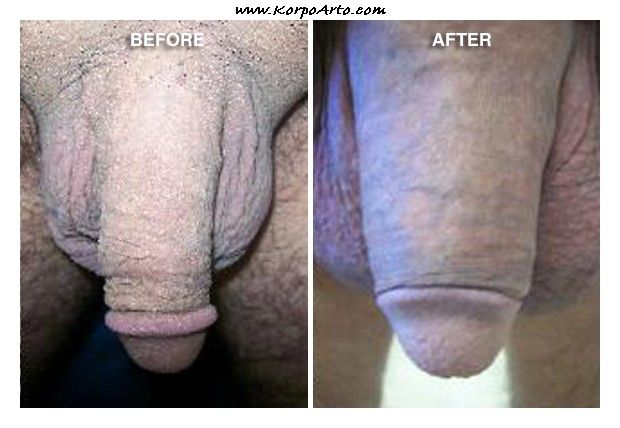 before and after huge cock