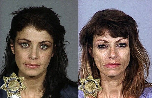 coke addicts before and after