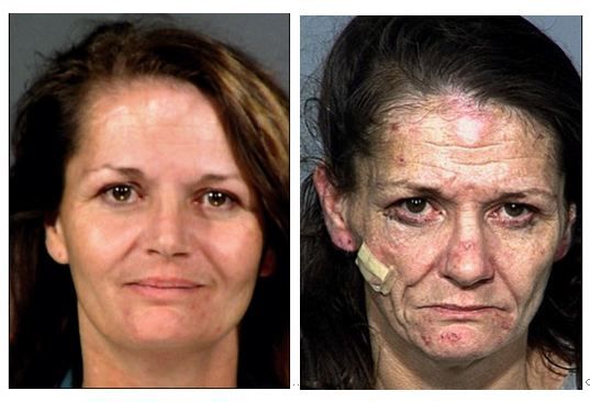crystal meth before and after