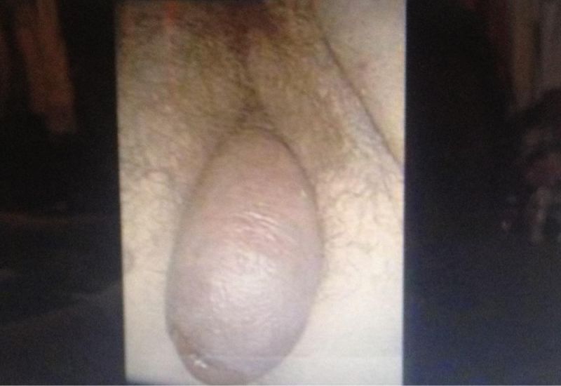 penis in vaginal