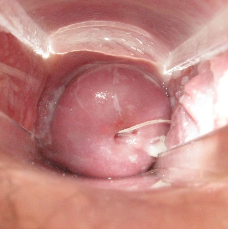 Penis Into Cervix Cumception