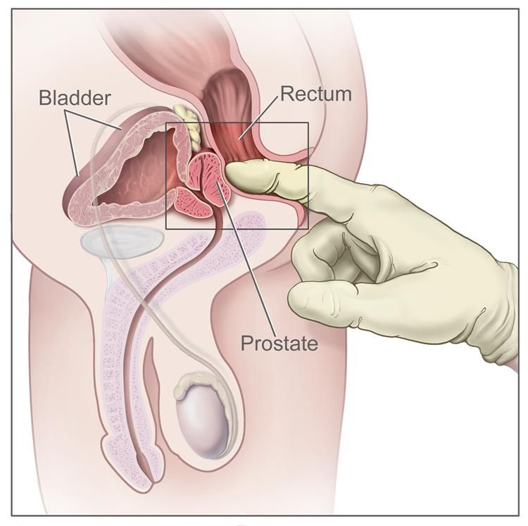 human prostate