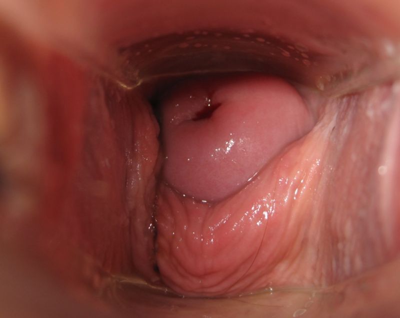 inner vagina