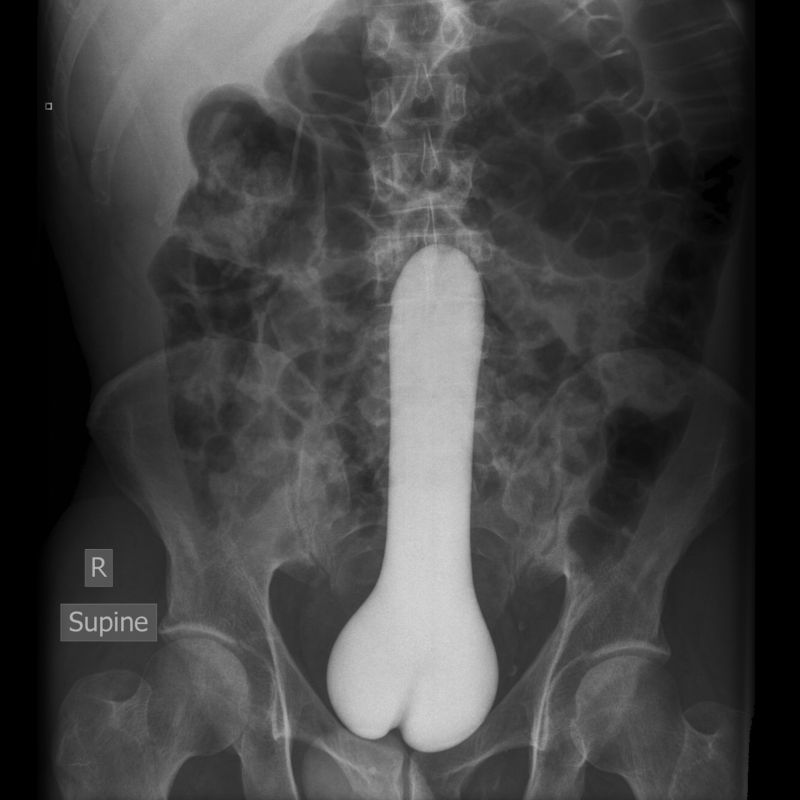 real anal x rays