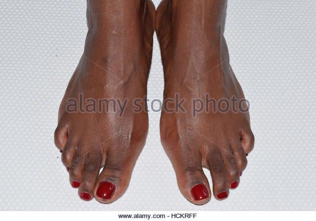 black women toenails heels