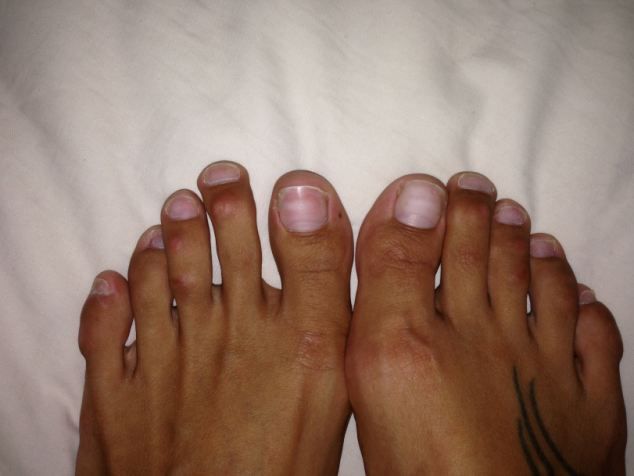 women toenails gold black