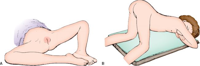 dorsal lithotomy position examination