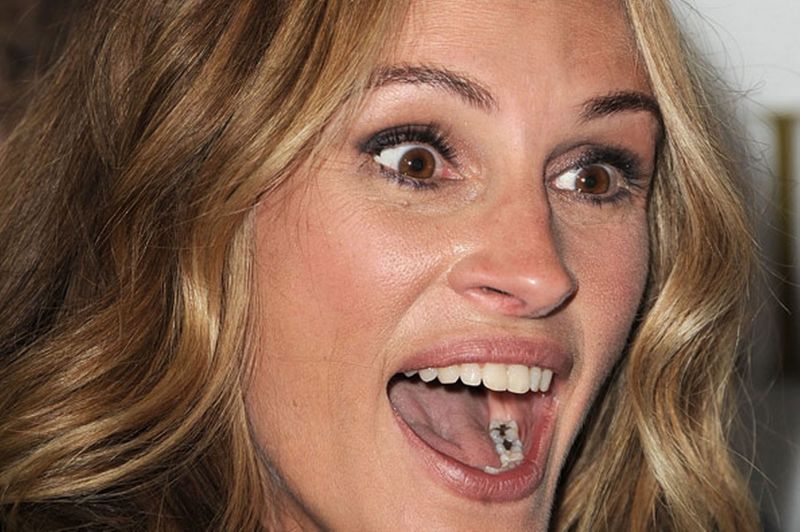 julia roberts teeth fillings