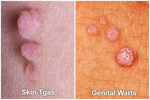 vagina lips swollen after sex