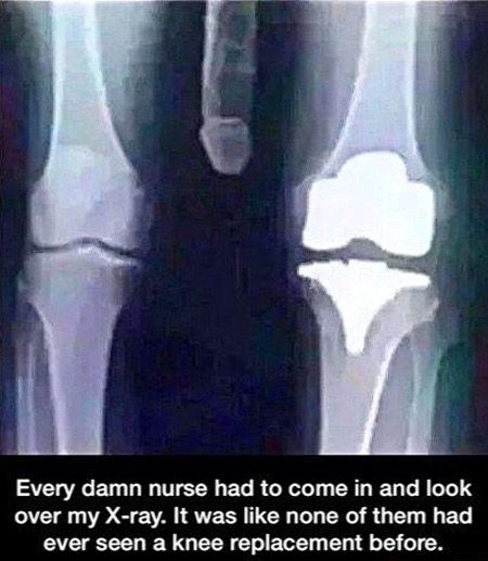 normal knee x ray