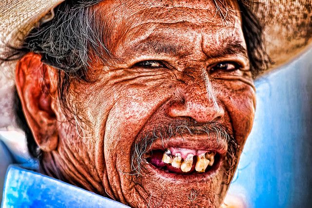 people with messed up teeth