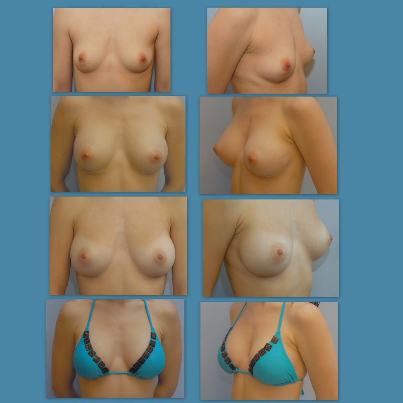 visual breast cup size chart