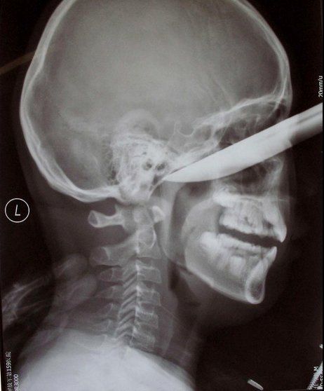Deepest Throat X Ray - Cumception