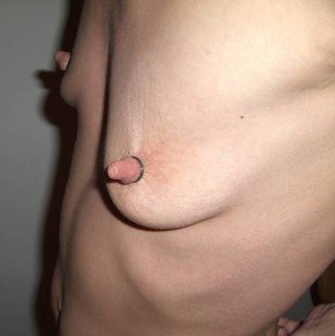 flat saggy tit breast shapes