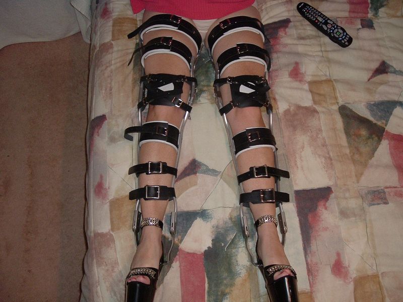 leg cast