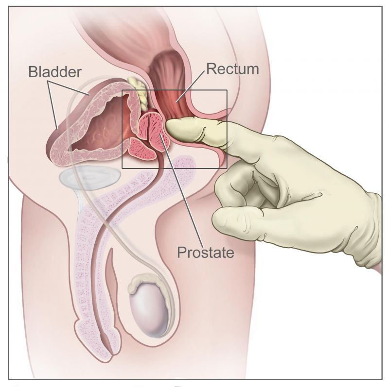 prostate testing for men