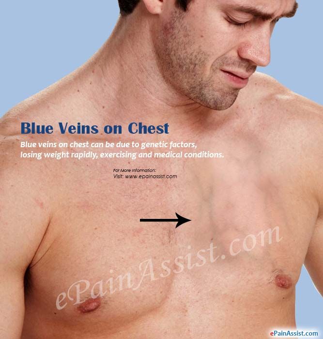 visible veins in breasts