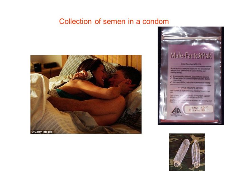 condom filled with multiple loads
